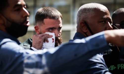 «Канело» нанес Планту рассечение во время потасовки на пресс-конференции. Фото