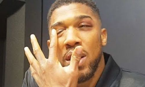 «Силы оставили его». Энтони Джошуа госпитализирован после поражения Александру Усику