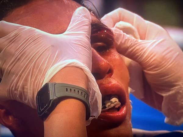 Странным решением и жутким зрелищем закончился громкий реванш экс-чемпиона мира. Фото и видео