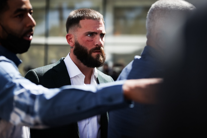 «Канело» нанес Планту рассечение во время потасовки на пресс-конференции. Фото