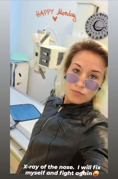 «Починюсь». Мария Агапова рассказала о последствиях своей второй победы в UFC