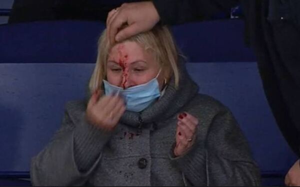 Соперники «Барыса» в матче КХЛ  разбили женщине лицо шайбой. Фото