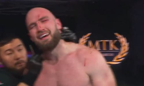 Камшыбек Кункабаев наградил своего соперника «шрамом Гарри Поттера». Фото