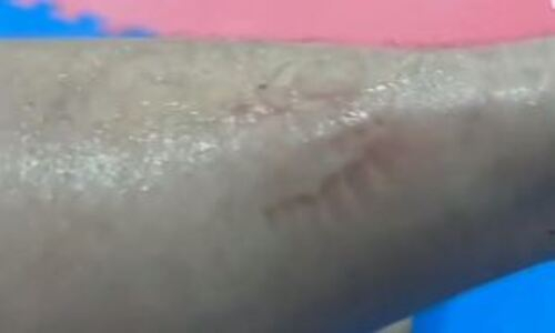 «Че это такое?». Бойца UFC покусали в Казахстане. Видео