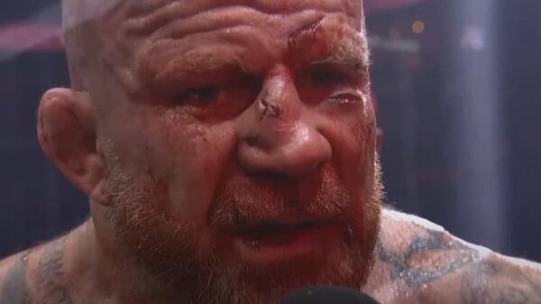 Появилось фото лица Джеффа Монсона после боя на голых кулаках с Александром Емельяненко