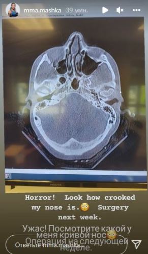Казахстанка из UFC показала ужасающее фото