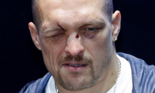 «Мне было нелегко». Усик рассказал о реакции братьев Кличко на его отъезд из Украины