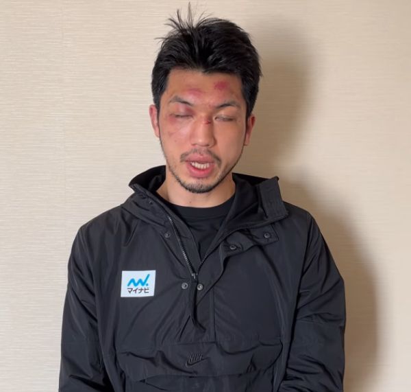 Появилось фото лица Мураты на следующий день после избиения Головкиным