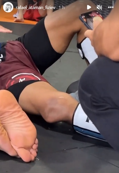 Уроженец Казахстана из UFC показал фото шокирующей травмы