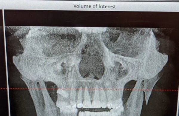 45-летний кубинский боец сломал сопернику челюсть после трех нокдаунов. Фото