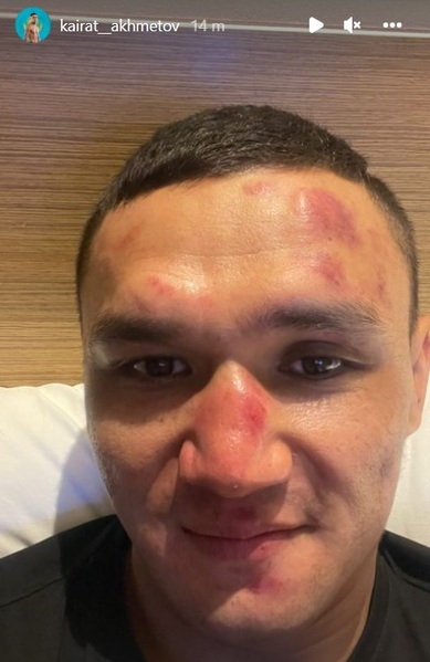 Кайрат Ахметов показал лицо после кровавой зарубы с японцем