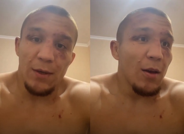 Фаниль Рафиков показал избитое лицо после фиаско в бою с узбекистанцем
