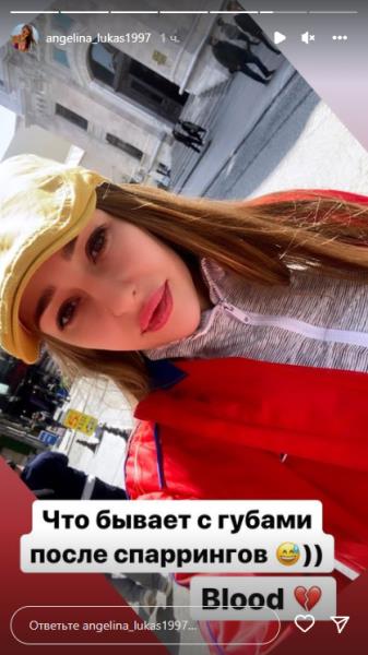 «Вот что бывает». Самая сексуальная боксерша Казахстана показала свои губы после спарринга. Фото