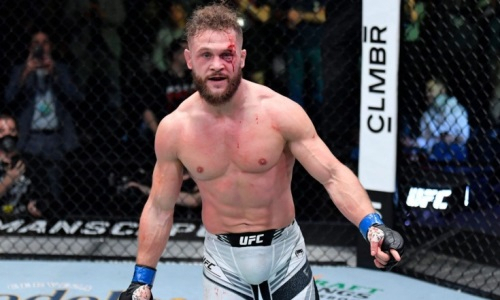 Уроженец Казахстана показал фото сломанного носа после победы над экс-чемпионом UFC