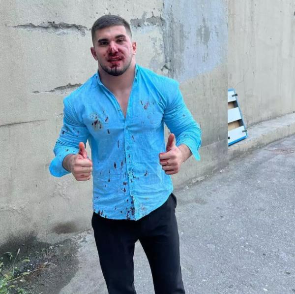 Окровавленный блогер-боец из Чечни показал себя сразу после избиения в Дагестане. Фото