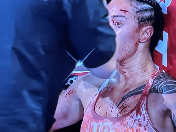 Бой самой миловидной чемпионки мира обернулся жестким кровавым махачем. Видео