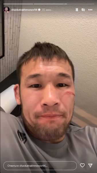 Опубликовано фото лица Шавката Рахмонова после его самого сложного боя в UFC