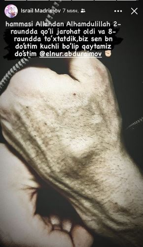 Раскрыта причина сенсационного поражения непобежденного казахского боксера из Узбекистана. Фото