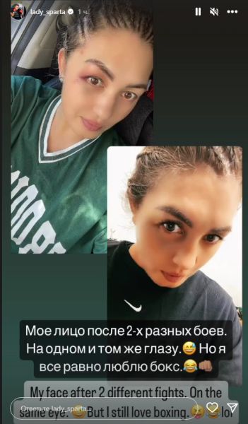«Я все равно люблю бокс». Казахстанка из США показала ужасающие фото лица после боев