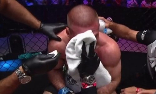 Появилось жуткое фото лица Артема Резникова после нокаута в финале Гран-при АСА