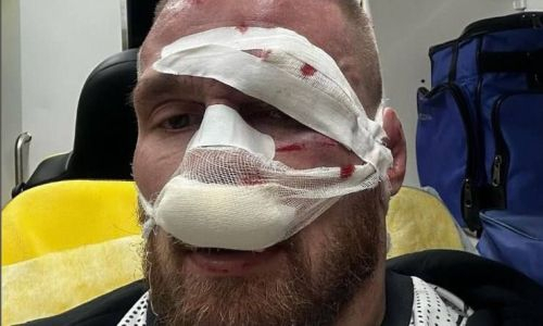 Бойца из Казахстана госпитализировали после долгожданного поединка