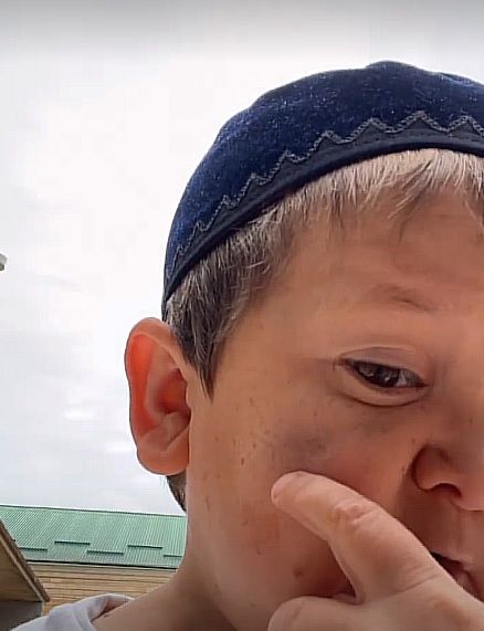 «Толпой хотели меня избить». Хасбику поставили синяк во время драки. Фото