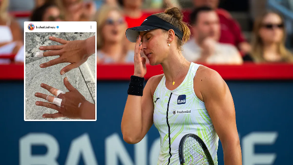 Соперница Рыбакиной по Уимблдону-2023 изрезала себе руки в отеле