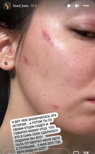 Бывшая жена Дмитрия Бивола обвинила его в домашнем насилии