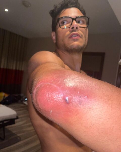 Выйдет на бой? Пауло Коста перенес операцию перед поединком с Хамзатом Чимаевым