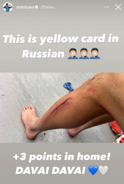 «В России за это дают желтую карточку». Одноклубник Зайнутдинова показал последствия жуткого фола