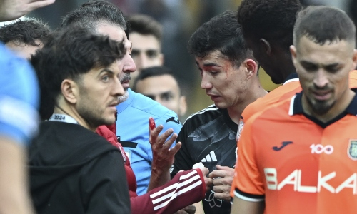 В Турции покадрово разобрали момент с травмой Зайнутдинова и вынесли вердикт