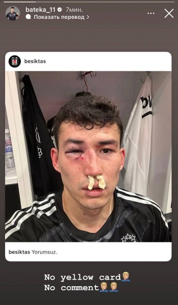 Бактиер Зайнутдинов сделал первое заявление после шокирующей травмы