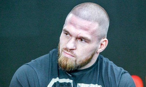 Артем Резников назвал способ избежать критики