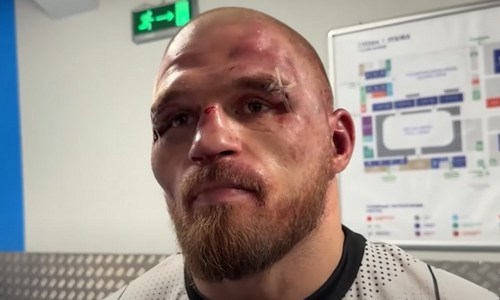 В ACA отреагировали на неожиданное решение звезды казахстанского ММА