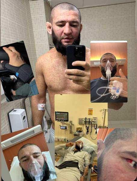 Хамзат Чимаев поразил своим внешним видом из-за тяжелой болезни. Фото