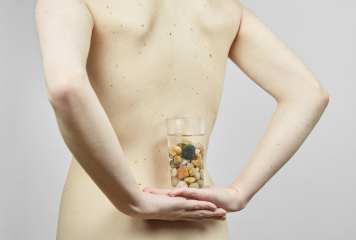 Ученые назвали напиток для профилактики камней в почках