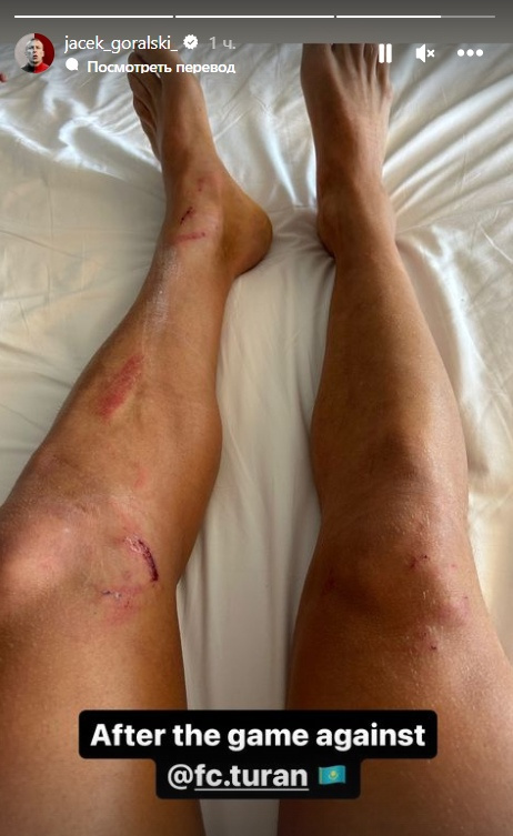 Экс-игрок «Кайрата» получил травму в матче с клубом КПЛ. Фото