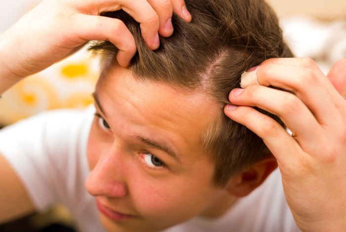 Доктор медицинских наук назвала восемь причин выпадения волос