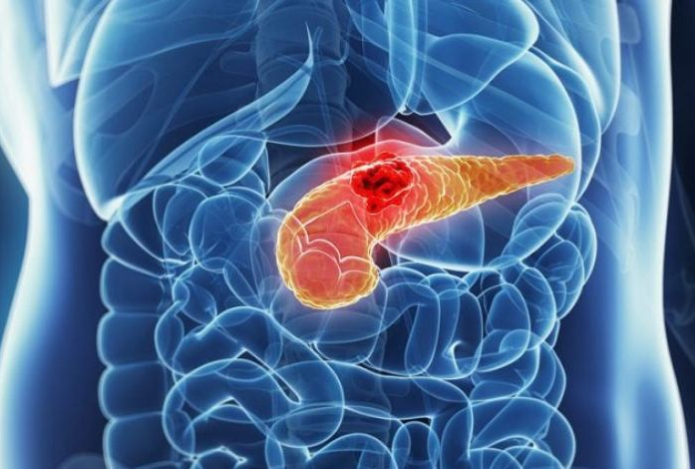 Замороженные продукты могут вызвать рак. Откажитесь от них