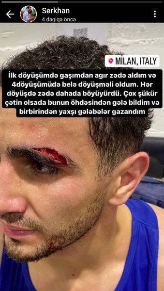 Азербайджанский боксер высказался и показал свою травму после поражения капитану сборной Казахстана. Фото