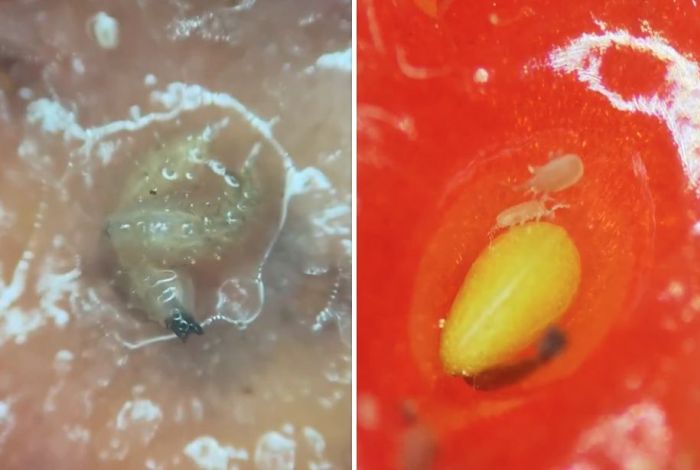 Личинки насекомых нашли в ягодах. Шокирующие фото клубники под микроскопом
