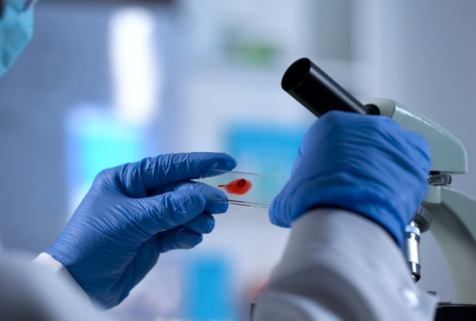 Учёные нашли способ уничтожить вирус, вызывающий СПИД