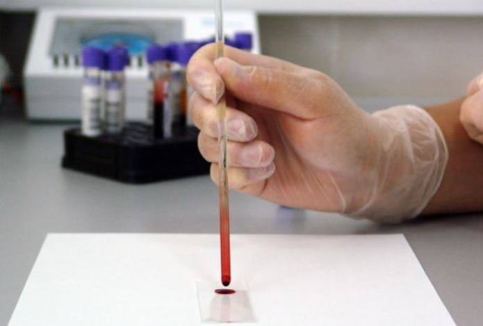 Ученым удалось открыть группу крови долгожителей — они реже страдают от заболеваний сердца