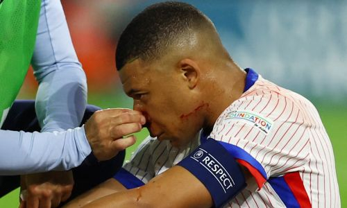 Мбаппе сломали нос в первом матче на Евро-2024