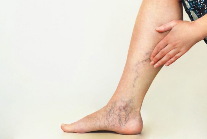 Названы продукты, которые спасут от тромбоза