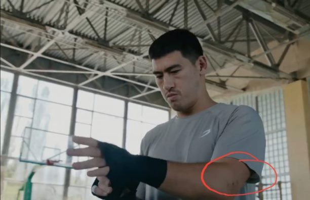 Бивол получил травму перед боем против Бетербиева за «абсолют». Фото