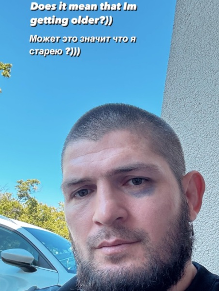 Хабибу Нурмагомедову поставили фингал под глазом. Фото