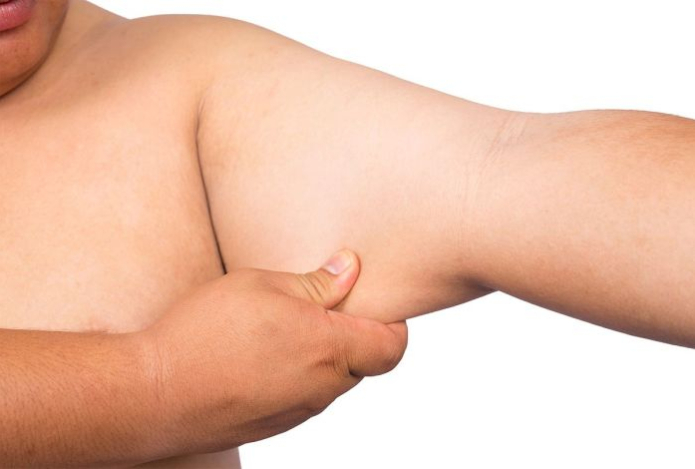 О чем говорит лишний жир на руках