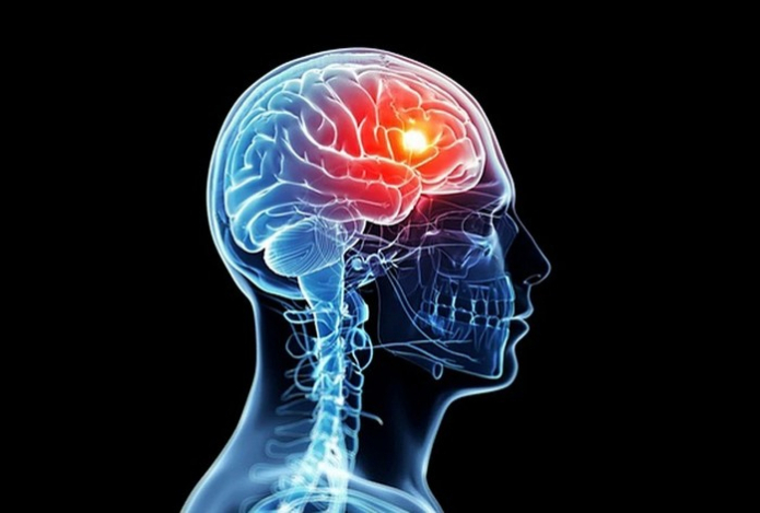 «Убойный комплект». Эти пищевые ингредиенты застопорят мозг, забьют сосуды и нарастят живот — достаточно одной порции