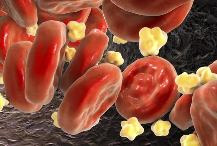 Анализ на холестерин покажет норму. Съели горсть этих семечек и забыли об угрозе бляшек — даже после 50 лет